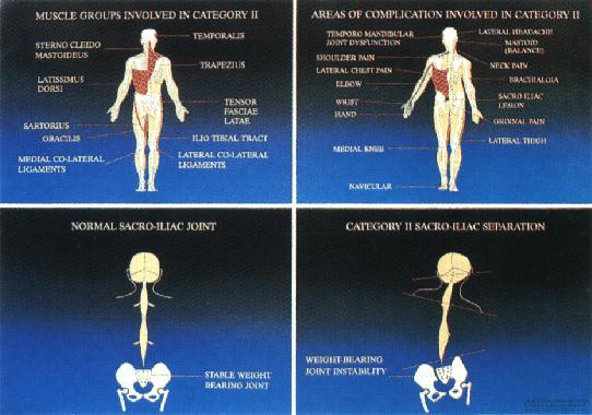 Sacro Occipital Technique Panama City FL - Bay Clinic Of Chiropractic